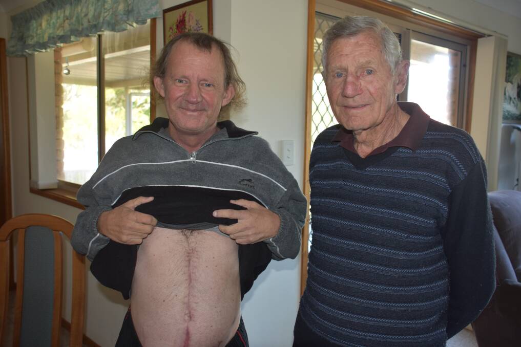Wayne Garvan proudly shows his transplant scar with his father Reg. 