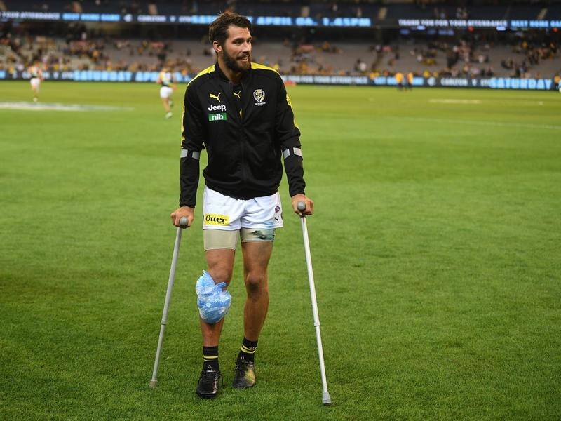 Alex Rance, who was injured in last week's AFL clash with Carlton, is a massive loss for the Tigers.