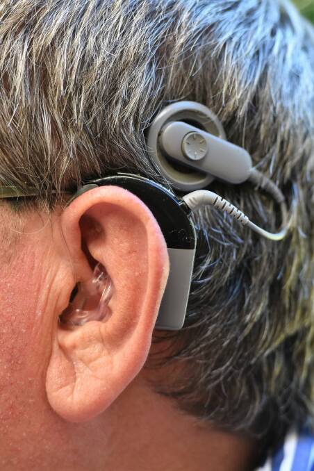 The cochlear implant
